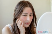 Skin barrier rusak seperti apa? Ini tanda-tandanya