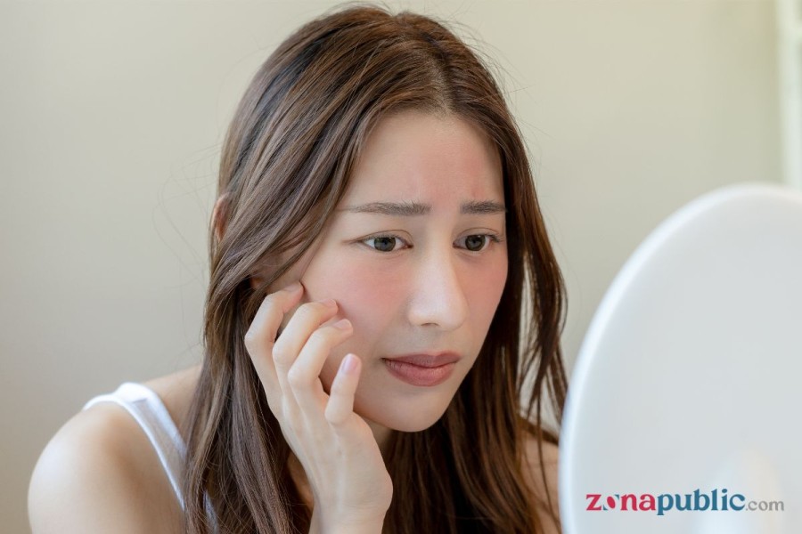 Skin barrier rusak seperti apa? Ini tanda-tandanya